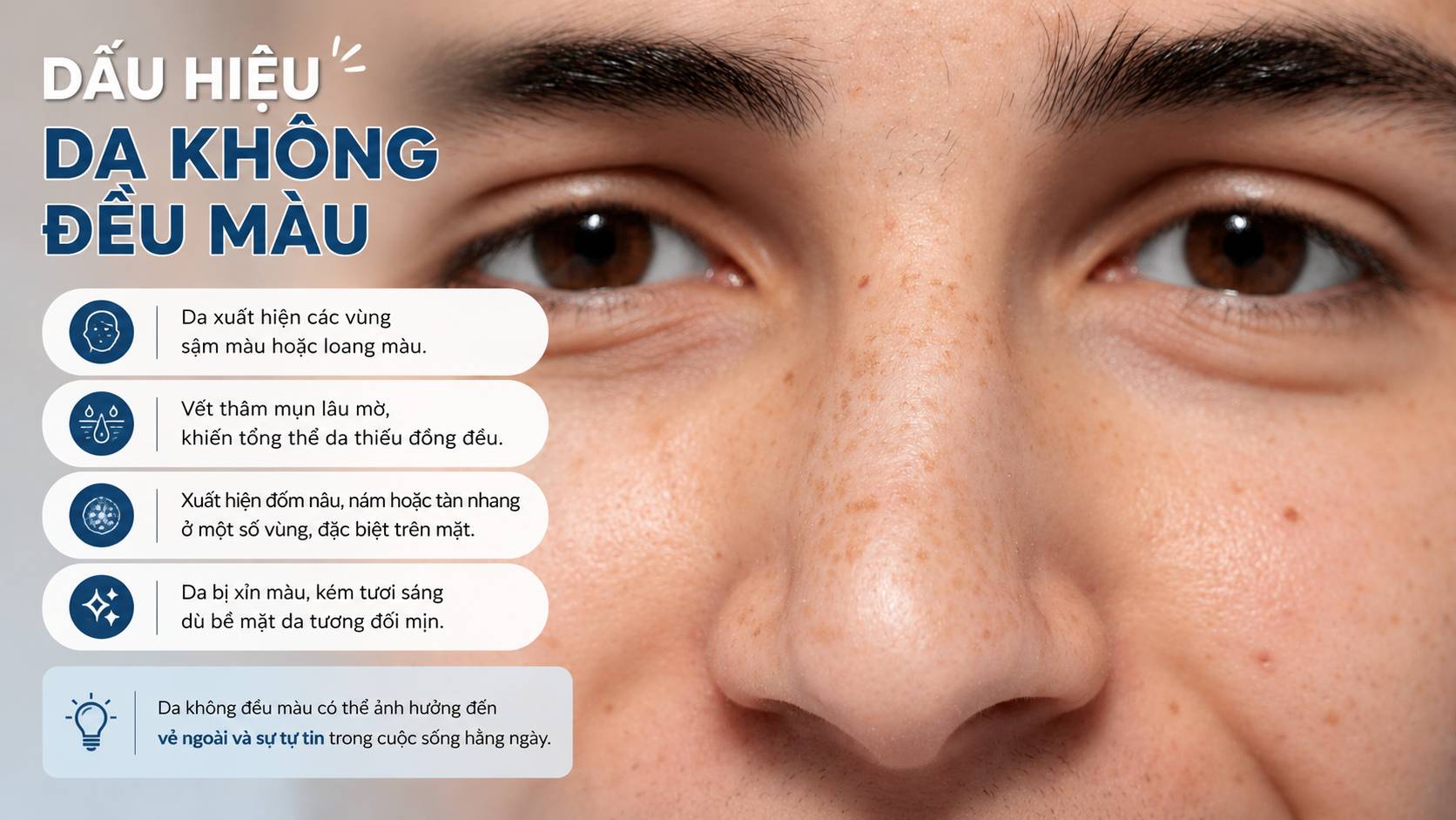 Da không đều màu khiến một số vùng da sẫm hoặc nhạt màu hơn vùng xung quanh.