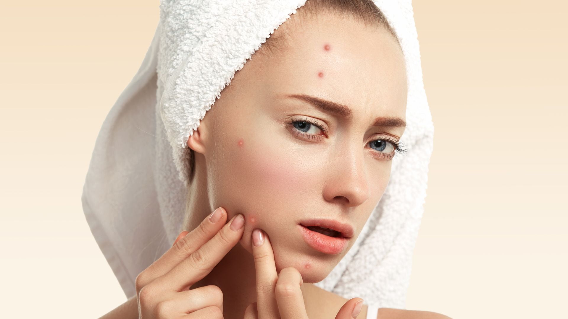 Không nặn mụn giúp da hạn chế kích ứng và phục hồi nhanh hơn trong quá trình chăm sóc mụn