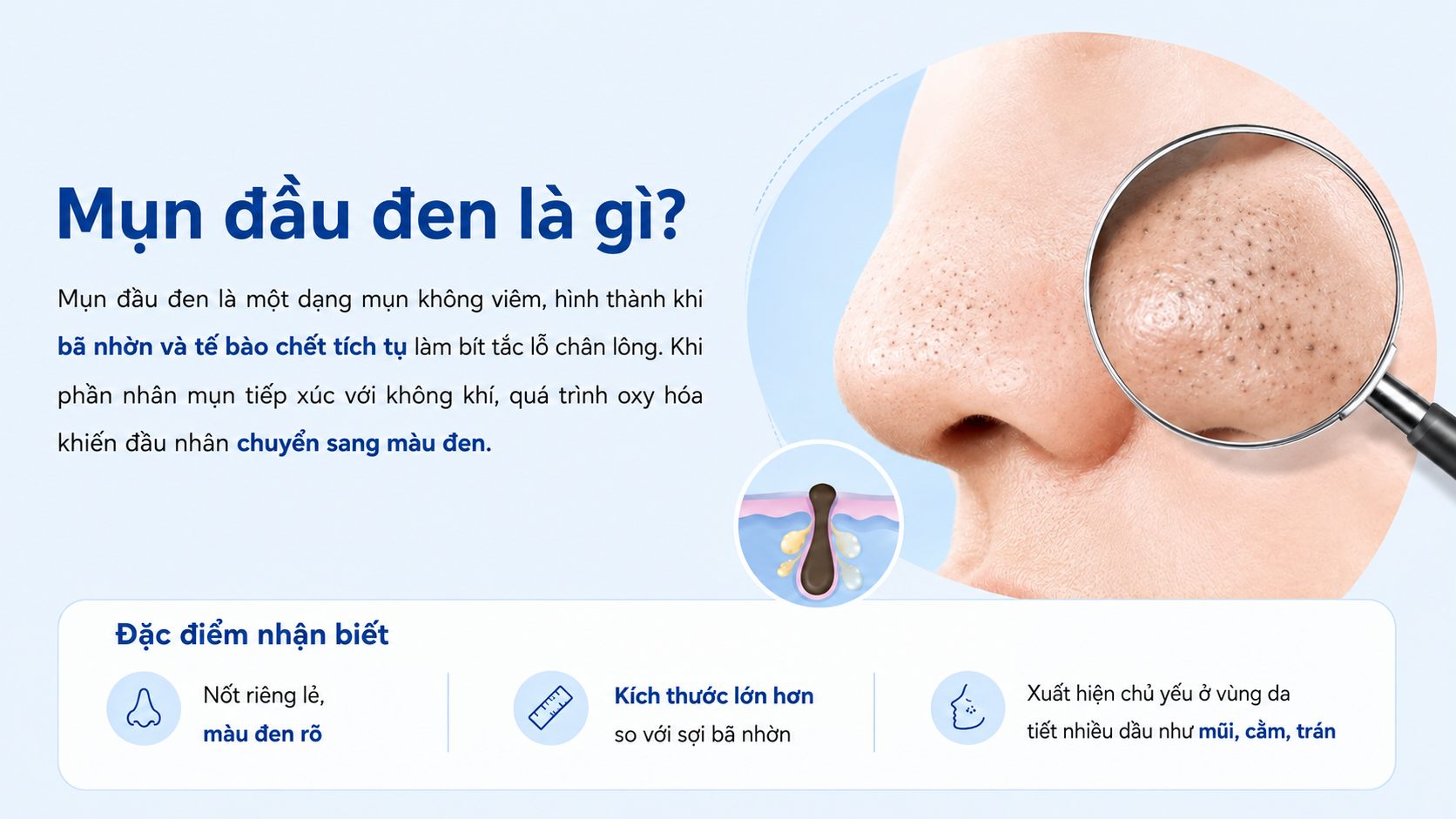 Mụn đầu đen thường là những nốt đen nhỏ, rõ và nổi bật trên bề mặt da, nhất là ở vùng mũi, cằm và trán