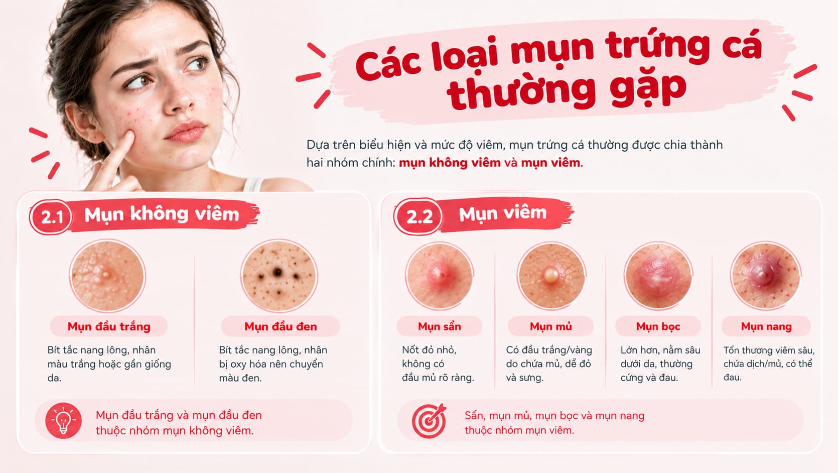 Các loại mụn trứng cá thường gặp