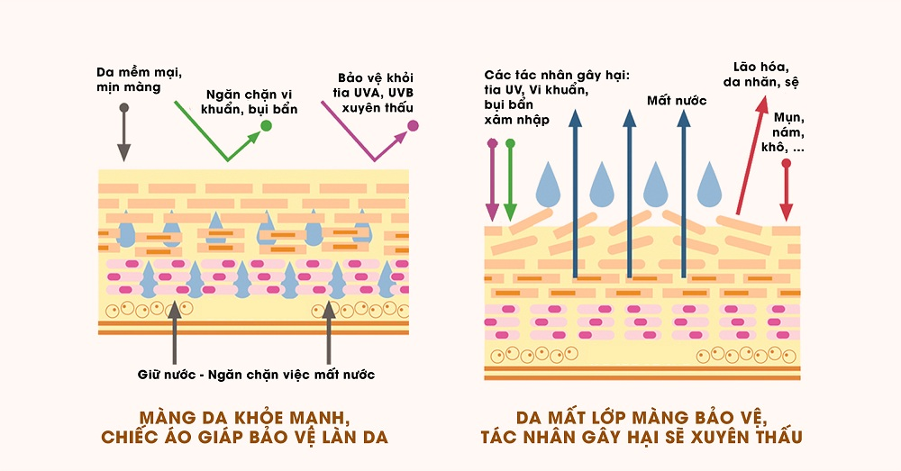 Hàng rào bảo vệ da