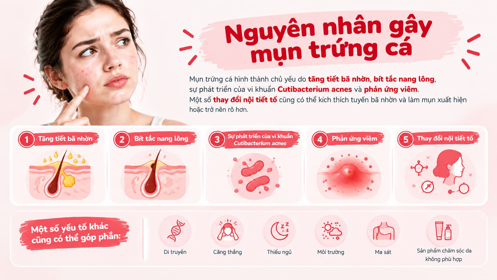 Nguyên nhân gây mụn trứng cá