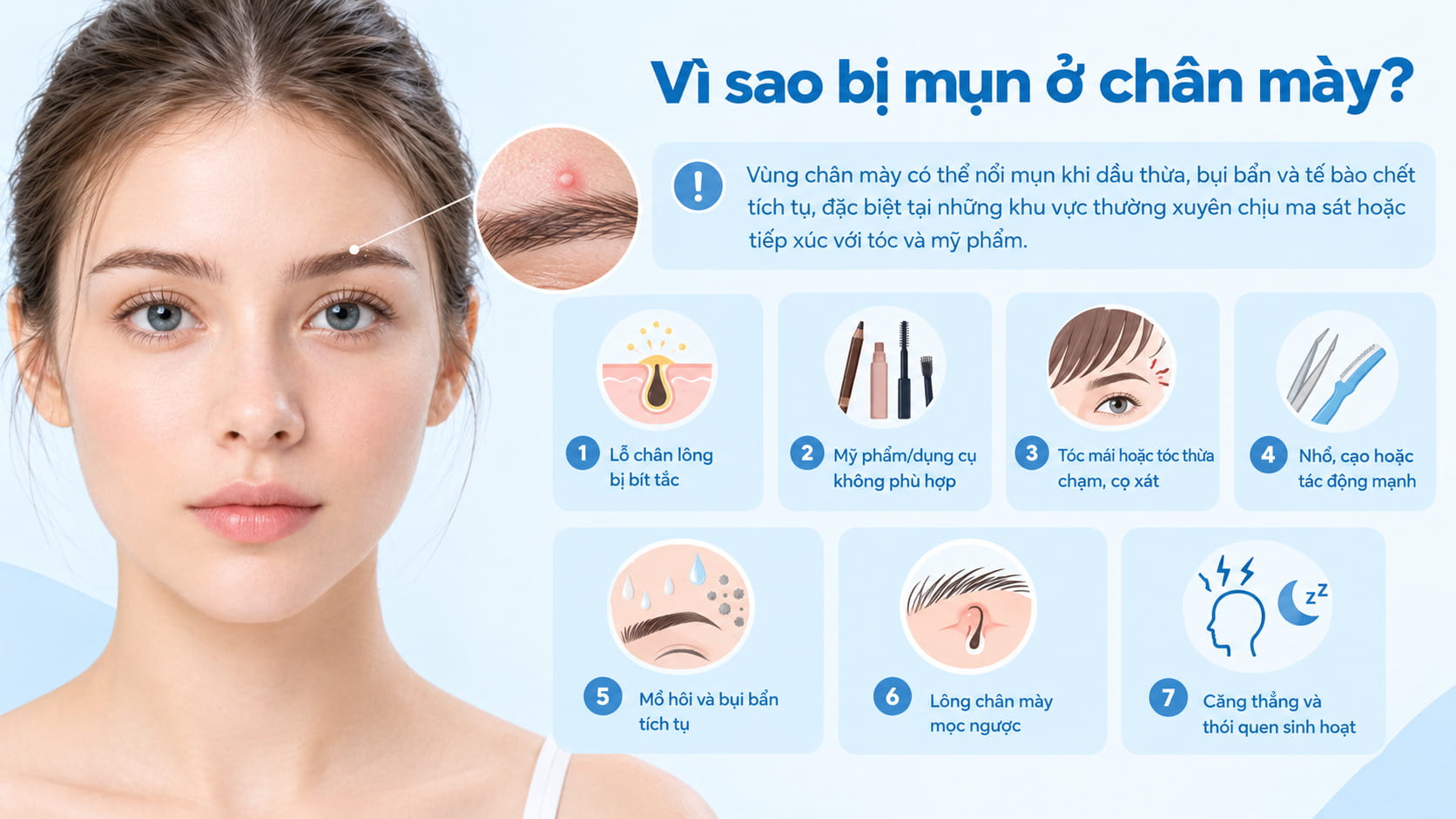 Vì sao bị mụn ở chân mày?