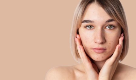 Nên bôi kem giảm mụn trước hay sau serum để đạt hiệu quả hơn?