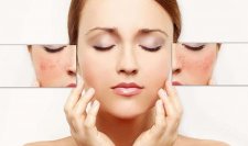 Cách phục hồi 3 loại da cần được bạn chăm sóc chuyên sâu