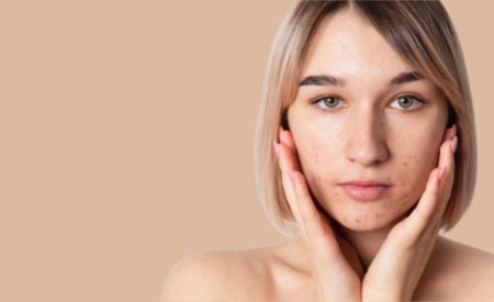 Nên bôi kem giảm mụn trước hay sau serum để đạt hiệu quả hơn?