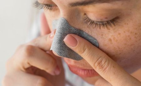 Mụn đầu đen và sợi bã nhờn: Cách phân biệt và chăm sóc