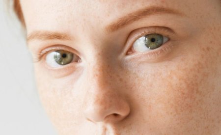 Da không đều màu: Nguyên nhân và cách cải thiện hiệu quả
