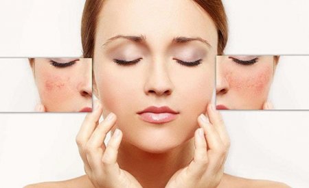 Cách phục hồi 3 loại da cần được bạn chăm sóc chuyên sâu