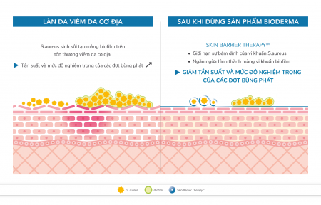 Da khô rát, nứt nẻ