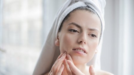 Duy trì thói quen ổn định giúp giảm các yếu tố làm mụn dễ quay lại