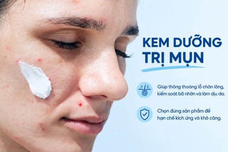 Kem trị mụn là gì