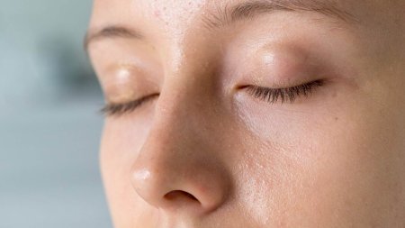 Da bóng dầu nhưng vẫn có thể thiếu nước khi hàng rào bảo vệ da mất cân bằng
