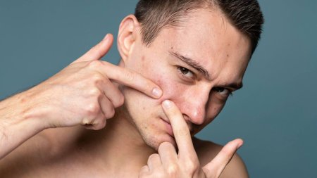 Việc chạm tay, nặn hoặc cạy mụn có thể làm tăng viêm và nguy cơ thâm sẹo