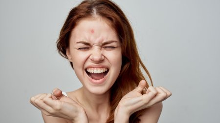 Nổi mụn ở trán liên quan đến sự tích tụ độc tố trong cơ thể