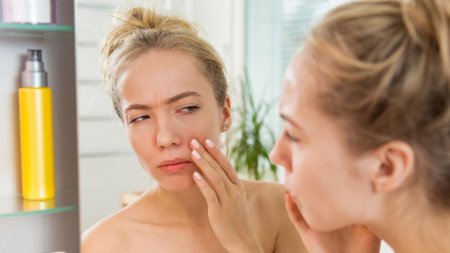 Hoạt chất nồng độ cao có thể khiến da bị châm chích và nóng rát