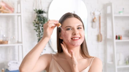 Thoa kem hoặc serum trị mụn trước để hỗ trợ cải thiện tình trạng da