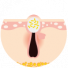 Tổn thương viêm
