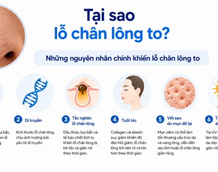nguyên nhân lỗ chân lông to